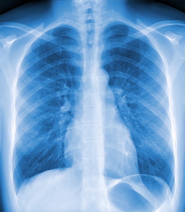 Anatomy of the Thorax – Meddists